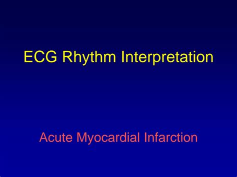Solution Acute Myocardial Infarction Ecg Interpretation Ppt Studypool