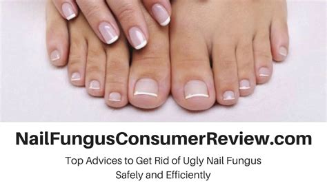 Best Toenail Fungus Treatment Reviews Dont Be Confused Anymore