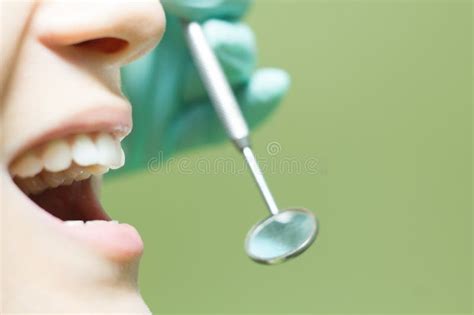 Woman White Teeth Stock Photo Image Of Patient Inspection 68436292