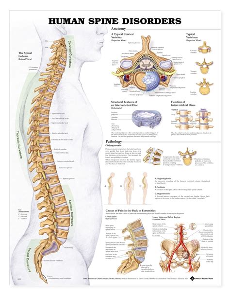 Anatomical wall charts and posters from 3b scientific® are ideal for teaching human anatomy, patient education and medical studies! Human Spine Disorders Chart / Poster 9781587794438