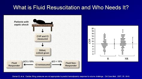 Are all def fluid brands the same? IV Fluid Resuscitation (IVF Lesson 3 / Shock Lesson 4 ...