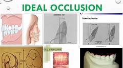 The Patients Essential Tool Andrews Patel Patient Portal Empowers Informed Decisions