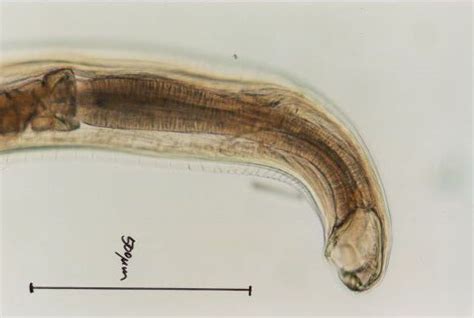 Ancylostoma Caninum