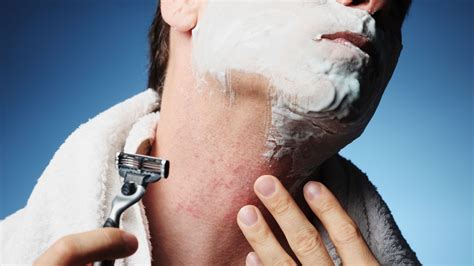 How To Prevent Treat Razor Bumps Barber Rash Blog By Xotics