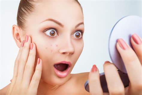Beauty Emergency That Untimely Red Spot On Your Cheek Beautyfrizz