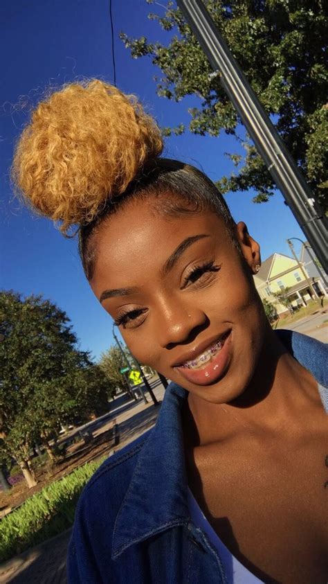 Girls With Braces💟 Braceface Curlygirl Naturalhair