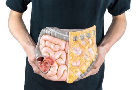Ulcerative colitis foods to avoid. Ischemic Colitis Diet: Foods to Eat and Avoid | Doctors ...