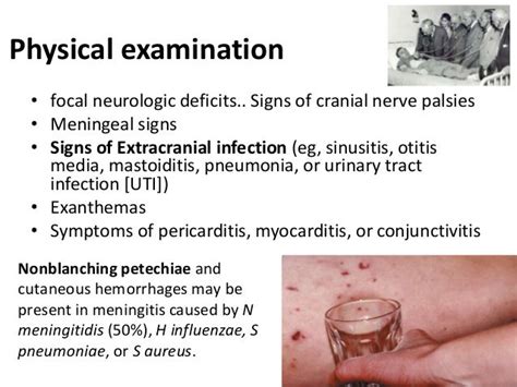 Meningitis Epidemiology Diagnosis And Management