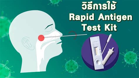 วิธีการใช้ Rapid Antigen Test Kit ชุดตรวจเชื้อโควิด 19 แบบเร่งด่วน