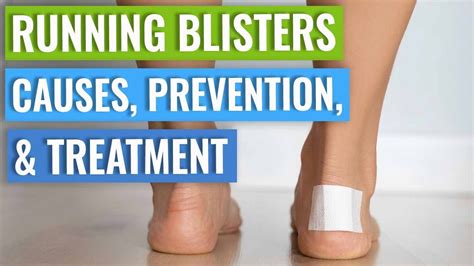 Running Blisters How To Prevent Blisters Running What Causes Them