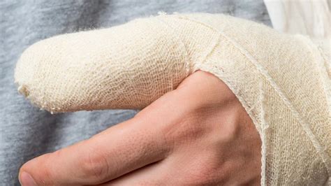 Broken Thumb Signs Symptoms And Treatment