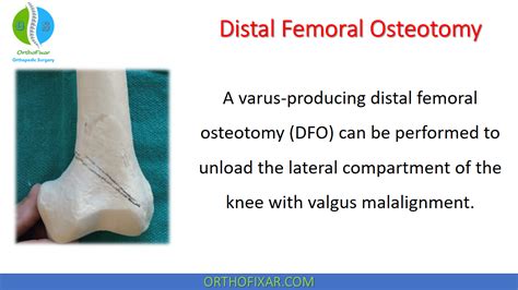 Distal Femoral Osteotomy