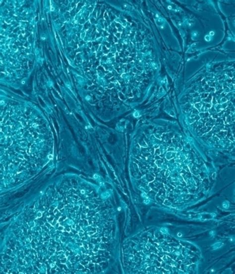 Stem Cells Summary