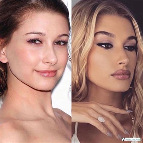 Review Of Celebrity Plastic Surgery Before And After Instagram