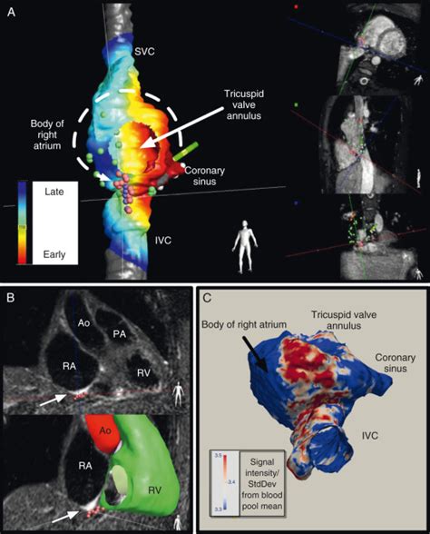 Pediatric Interventional Cardiovascular Magnetic Resonance Radiology Key
