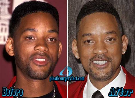 Will Smith Plastic Surgery Before After Pictures