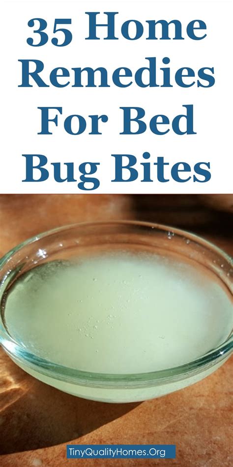 How To Get Rid Of Bed Bug Bites 35 Home Remedies
