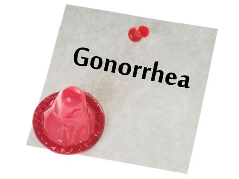 What Is Gonorrhea Healthy Living