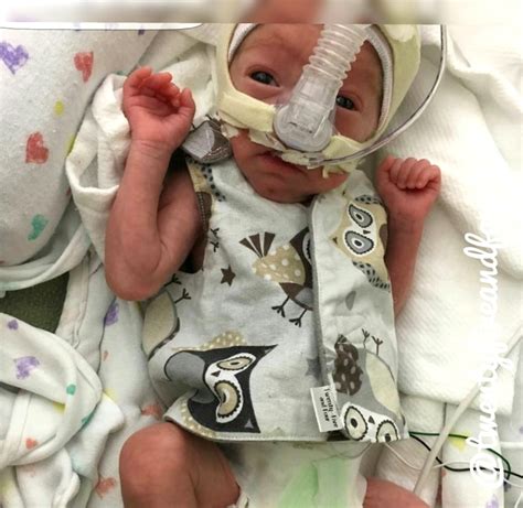 Mom Sews Tiny Outfits For Nicu Preemies Too Small For Standard Onesies