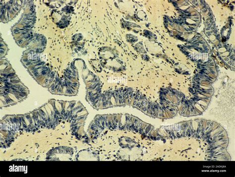 Trachea Epithelium Light Micrograph Of A Section Through The Wall Of