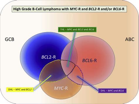 References In Burkitt Lymphoma And Other High Grade B Cell Lymphomas