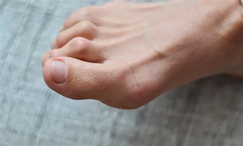 Capital Foot Ankle Podiatry Located In Sacramento Roseville And
