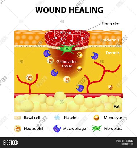 Process Wound Healing Vector And Photo Free Trial Bigstock
