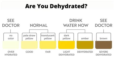Urine Color Meaning Adult And Pediatric Urology Urine Color Chart