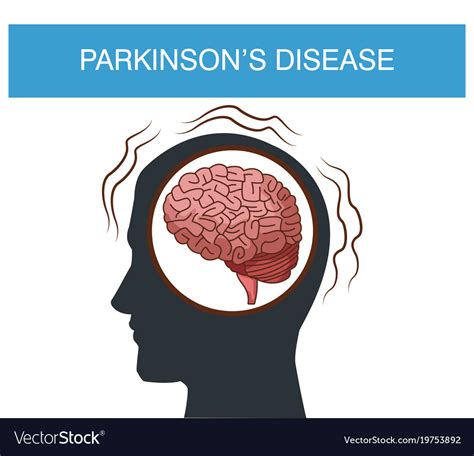 Parkinsons Disease Cartoon Royalty Free Vector Image