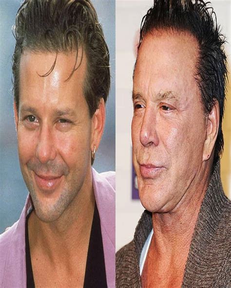 Top Background Images Celebrity Face Lifts Before And After