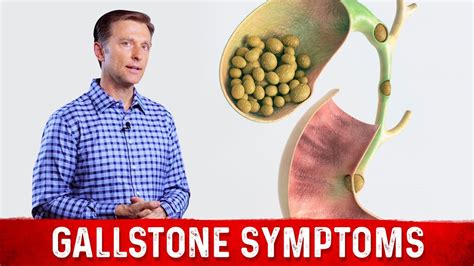 Gallstone Symptoms And Causes Explained Dr Berg On Gallbladder Stone Removal Safer Pain