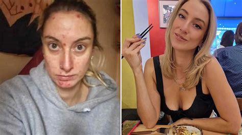 before and after pics show woman s incredible transformation after addiction saw her down two