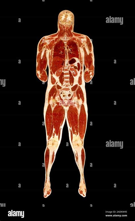 Male Body Sectioned Front View Of The Male Human Body Sliced Through