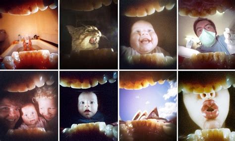 Pinhole Camera Takes Photos From Inside A Mans Mouth