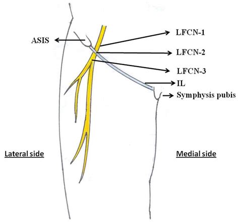 Anterior View Of The Right Thigh Shows The Sites Of Lfcn 1 Lfcn 2 And