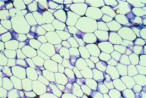 Lm Of White Adipose Tissue Photograph By Astrid And Hanns Frieder Michler