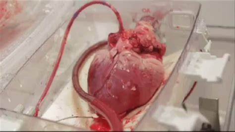 Check spelling or type a new query. Human Heart For Sale | Buy Human Heart Online | ORGAN CITY