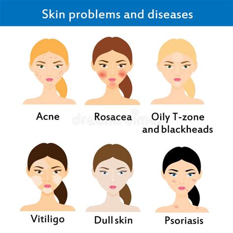 Skin Diseases Derma Infection Eczema And Psoriasis Stock Vector