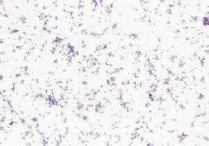 Streptococcus Pneumoniae Slide Vwr