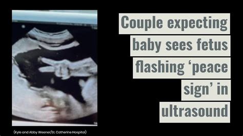 Couple Expecting Baby Sees Fetus Flashing ‘peace Sign In Ultrasound