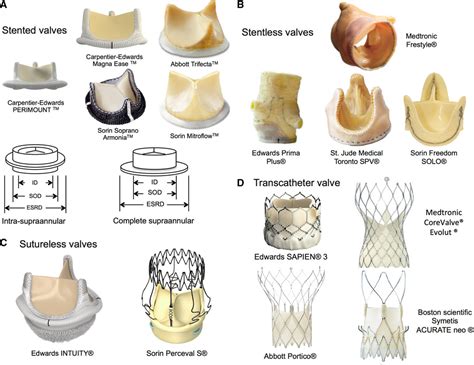 Aortic Stenosis And Small Aortic Annulus Circulation