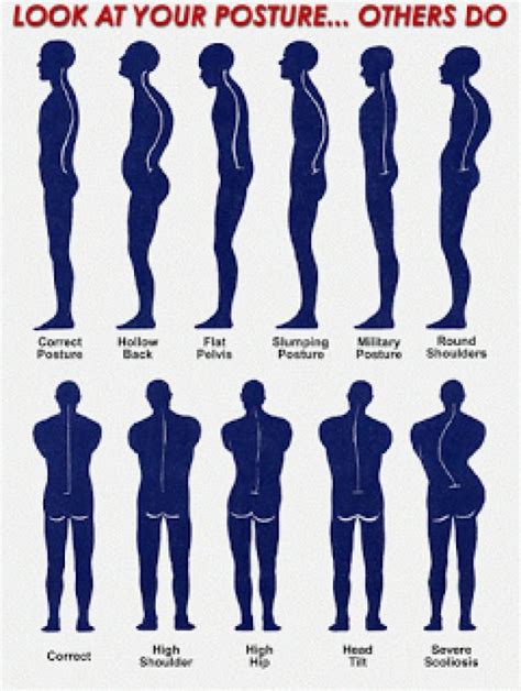 Posture Diagram Backpain Better Posture Posture Correction Good