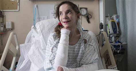 ‘butterfly Patient Hopes To Inspire Others With Epidermolysis Bullosa