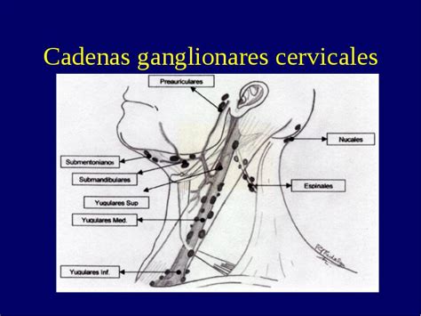 Adenopatias Cervicales En Niños Dra Gloria Paredes Guerra