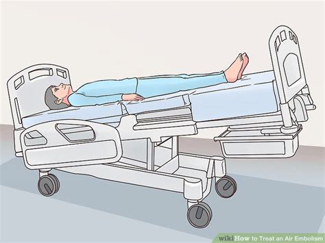 3 Ways To Treat An Air Embolism Wikihow