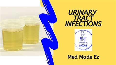 Urinary Tract Infections 4 Common Questions Answered Wbonus Facts