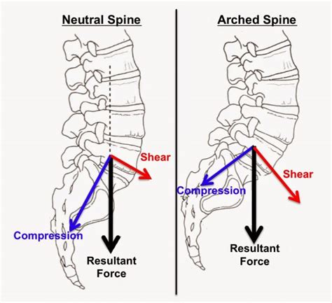 Back Pain Exercise Archives Spinal Backrack