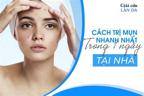 Tổng Hợp 31 Bài Viết Cách Làm Mụn Mủ Nhanh Khô Vừa Cập Nhật F5 Fashion