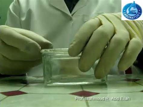 The five major categories of leukocytes in mammals are neutrophils, eosinophils, basophils, lymphocytes, and monocytes. Differential leukocytes (white blood cells) count (DLC ...