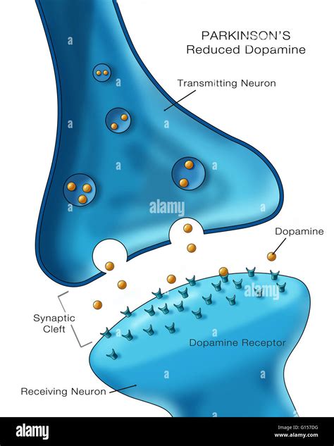 Labeled Illustration Showing Low Levels Of The Neurotransmitter